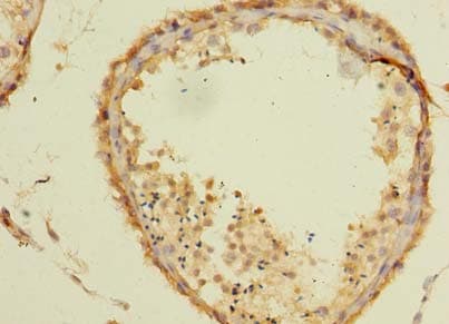 Polyclonal Rabbit anti-Human TSGA10 Antibody (IHC, WB)