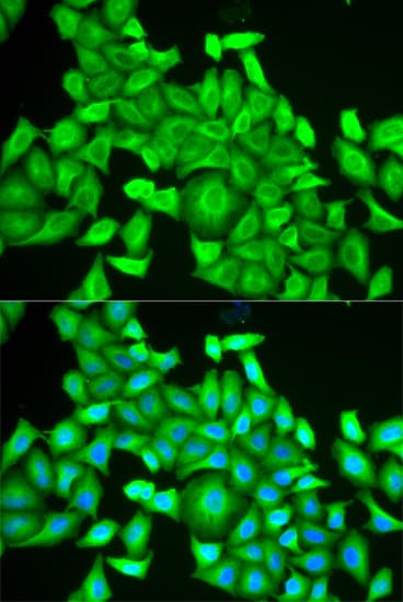 Polyclonal Rabbit anti-Human RAB6A / RAB6 Antibody (IHC, IF, WB)