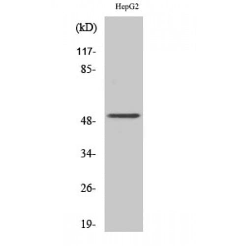 Polyclonal Rabbit anti-Human KRT13 / CK13 / Cytokeratin 13 Antibody (Internal, IHC, WB)