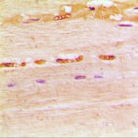 UNG / Uracil DNA Glycosylase Antibody (Internal)