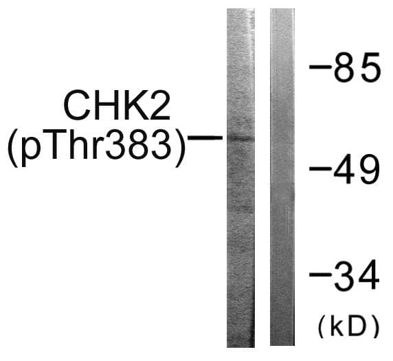 Polyclonal Rabbit anti-Human CHEK2 / CHK2 Antibody (phospho-Thr383, IF, WB)