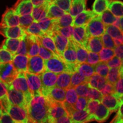 KRT19 / CK19 / Cytokeratin 19 Antibody (clone 400000000)