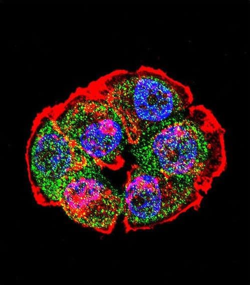 CTNNB1 / Beta Catenin Antibody (aa692-721)