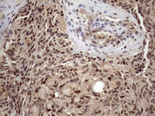 Monoclonal Mouse anti-Human BTEB / KLF9 Antibody (clone OTI8A11, IHC, WB)