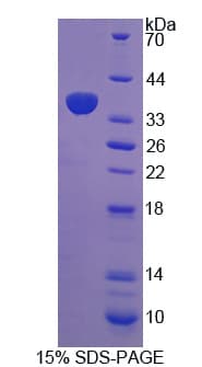 Human HCCS Protein (Recombinant His-T7)