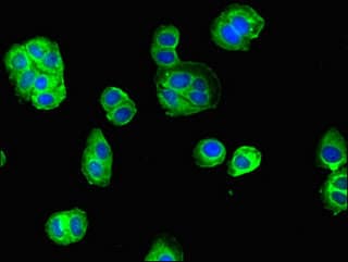HNE / Neutrophil Elastase Antibody (aa30-267)