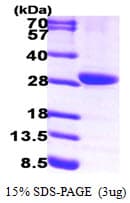 Human 15-PGDH / HPGD Protein (Recombinant His)