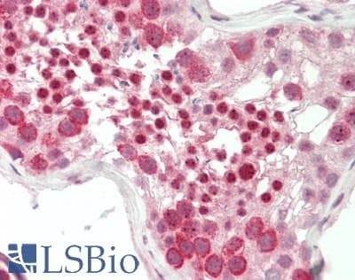 Polyclonal Rabbit anti-Human MBD1 Antibody (C-Terminus, IHC, WB)