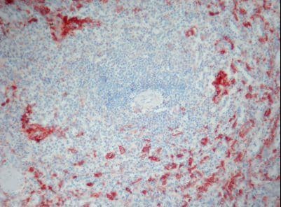 Monoclonal Mouse anti-Human AIF1 / IBA1 Antibody (clone 1022-5, IHC)