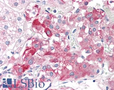 IHC-plus™ Polyclonal Rabbit anti-Human CARTPT / CART Antibody (IHC, WB)