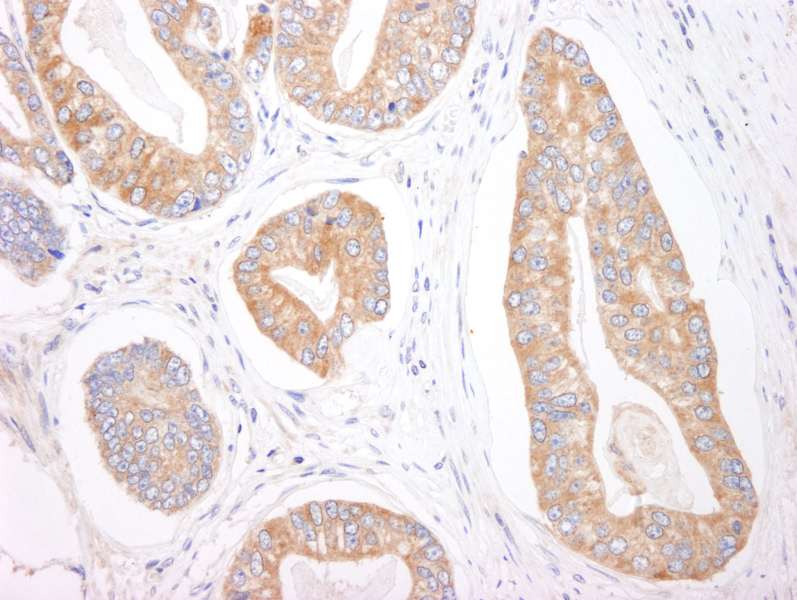 EIF4ENIF1 / 4E-T Antibody (aa925-C-term)