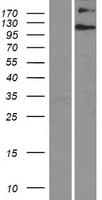 EVC / DWF-1 Protein (Over-Expression Lysate Myc-DDK (Flag))