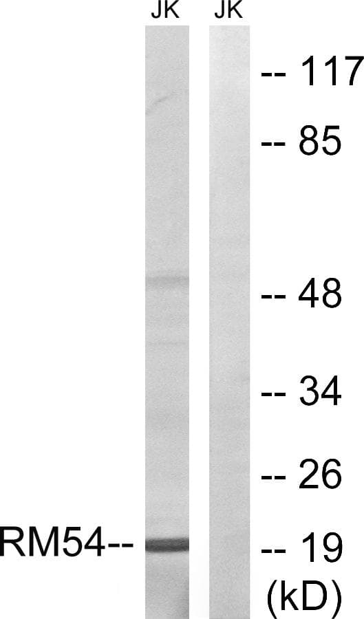 Polyclonal Rabbit anti-Human MRPL54 Antibody (IHC, WB)