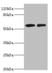 Polyclonal Rabbit anti-Human CARD9 Antibody (aa237-536, IHC, WB)