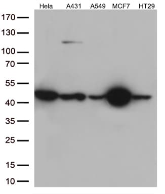 KRT18 / CK18 / Cytokeratin 18 Antibody (aa69-372, clone OTI10G8)