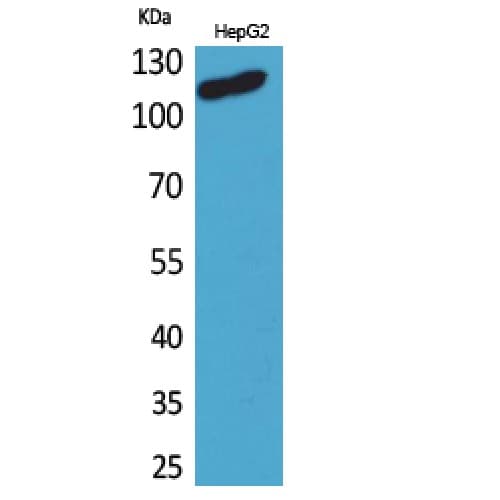 DPYD / DPD Antibody (351-400 aa, Internal)