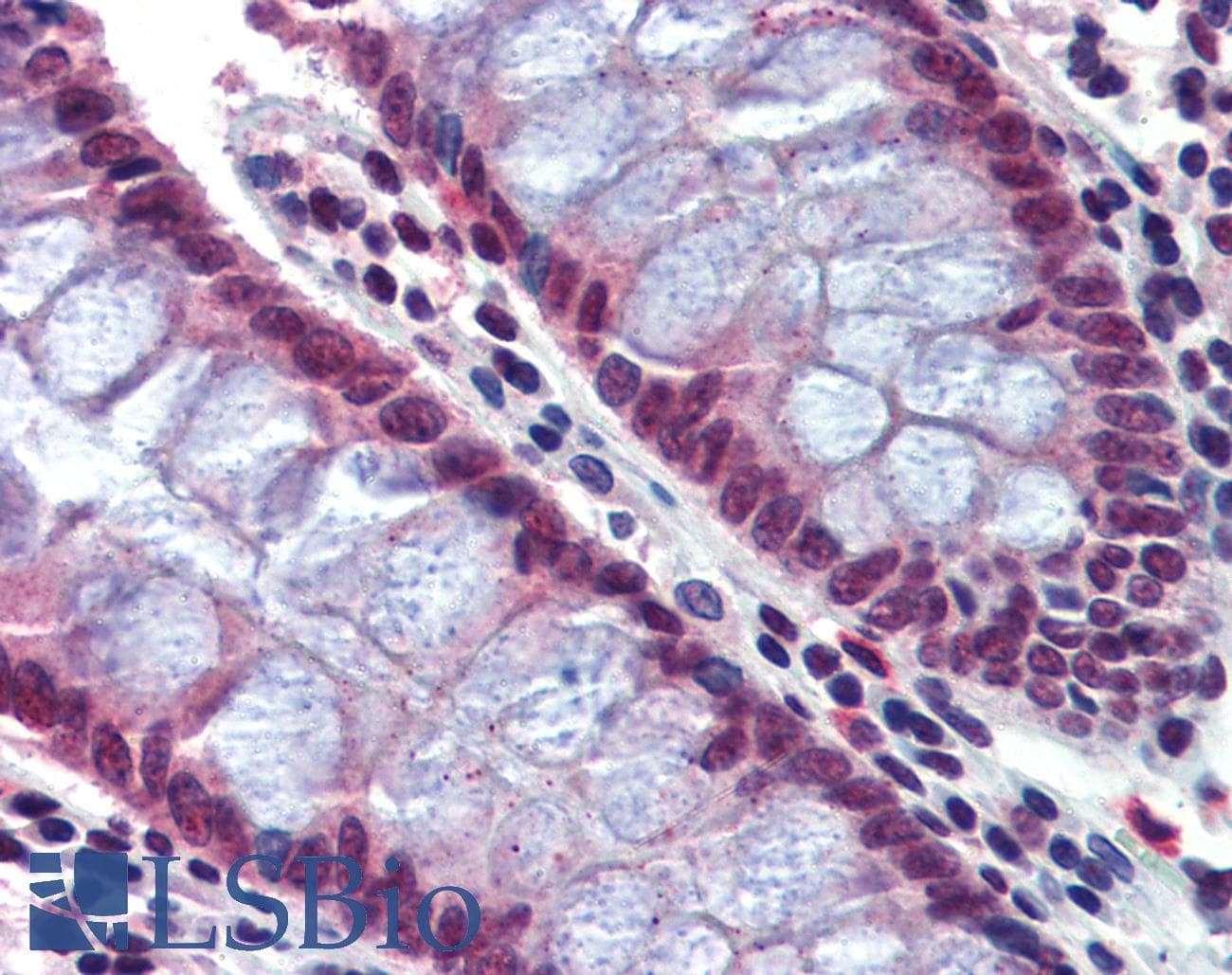 IHC-plus™ CASP7 / Caspase 7 Antibody