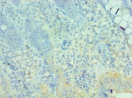 Polyclonal Rabbit anti-Human MTM1 / Myotubularin Antibody (aa484-603, IHC, WB)