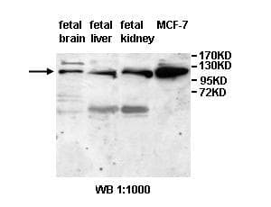 ANAPC2 / APC2 Antibody (aa604-820)