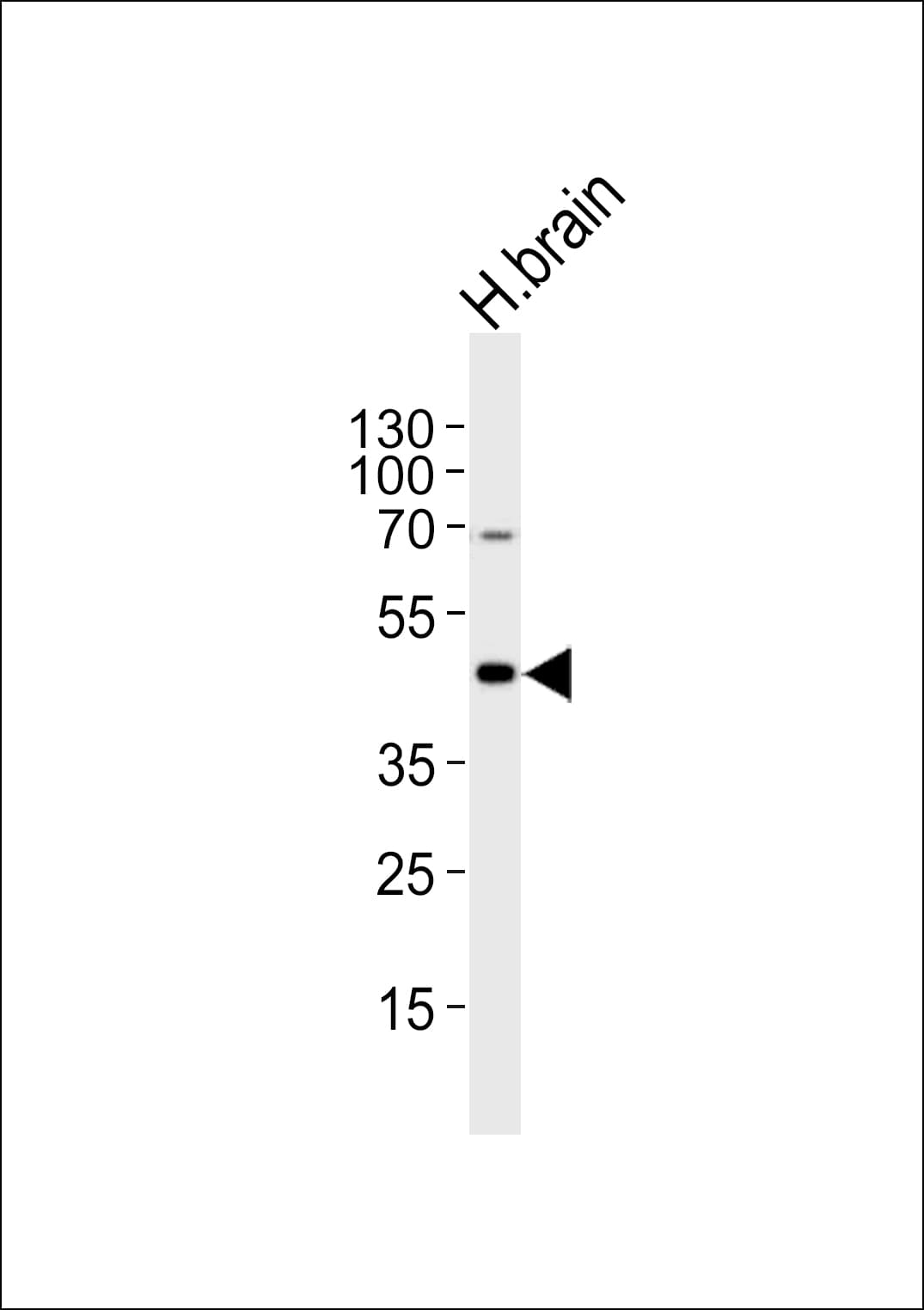 Polyclonal Rabbit anti-Human HTR1A / 5-HT1A Receptor Antibody (aa239-273, WB)