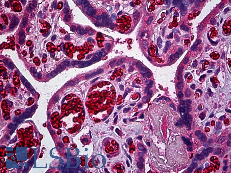 IHC-plus™ Monoclonal Mouse anti-Human ERBB3 / HER3 Antibody (clone 3F12, IHC)