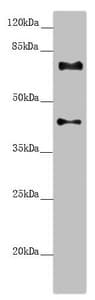 Polyclonal Rabbit anti-Human CEP72 Antibody (IHC, WB)
