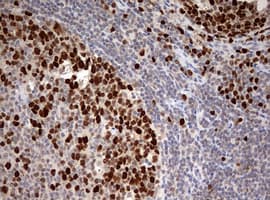 TOP2A / Topoisomerase II Alpha Antibody (aa1100-1531, clone OTI2A9)
