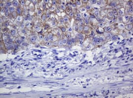 CDH1 / E Cadherin Antibody (clone OTI3E2)