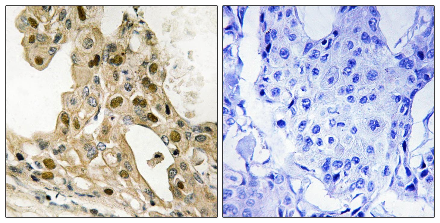 TP53 / p53 Antibody (phospho-Thr387)