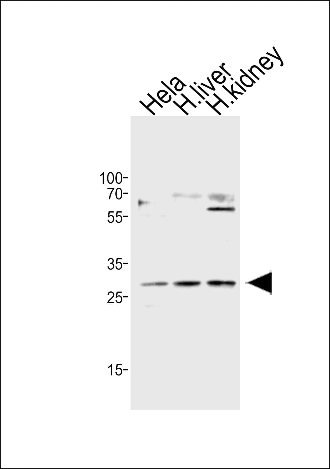CISH / SOCS Antibody