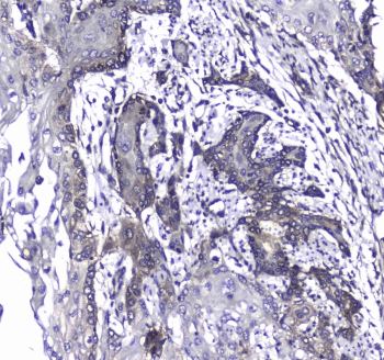 L1CAM Antibody