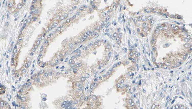 Polyclonal Rabbit anti-Human KRAS Antibody (aa159-184, IHC, WB)