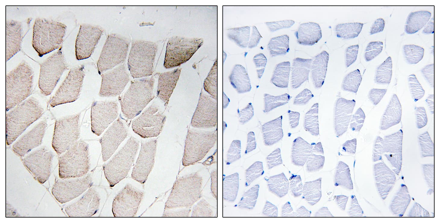 MYOM1 / Myomesin 1 Antibody (aa824-873)