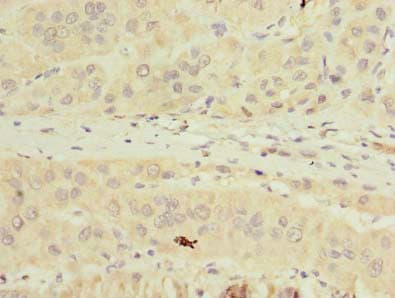 TMPRSS6 Antibody