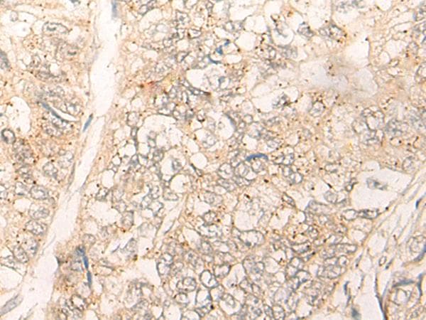 Polyclonal Rabbit anti-Human CUTA Antibody (IHC)