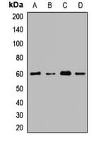 Polyclonal Rabbit anti-Human CDY1 Antibody (WB)