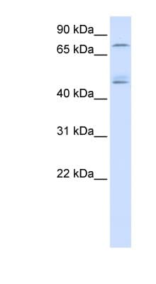Polyclonal Rabbit anti-Human DDX1 Antibody (aa36-85, WB)
