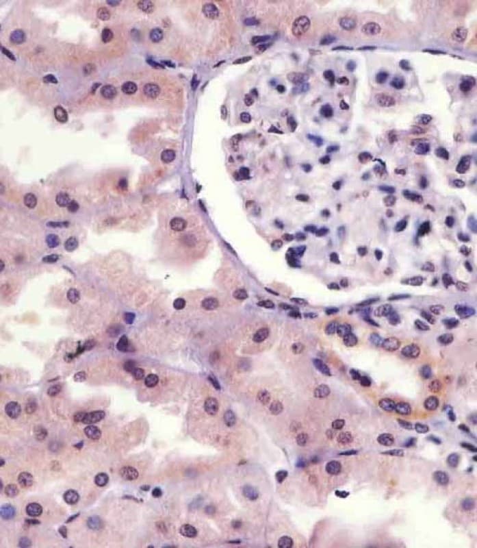 Polyclonal Rabbit anti-Human IRAK1 / IRAK Antibody (phospho-Ser376, IHC, IF, WB)