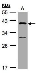 Polyclonal Rabbit anti-Human GIPC3 Antibody (aa1-44, WB)