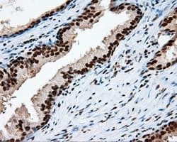 TLDC1 / KIAA1609 Antibody (clone OTI12B1)