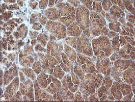 MAP2K3 / MEK3 / MKK3 Antibody (clone OTI2A7, Carrier-free)