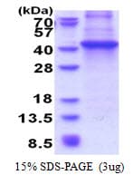 Human DOK4 Protein (Recombinant His)
