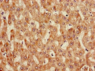 Polyclonal Rabbit anti-Human ANGPTL3 Antibody