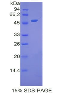 Human Apolipoprotein A-V (Recombinant His)