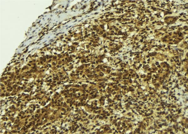 BCL2L13 / Bcl Rambo Antibody