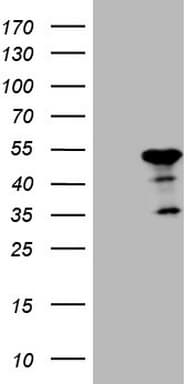 PDIA6 / ERP5 Antibody (clone OTI8H4)