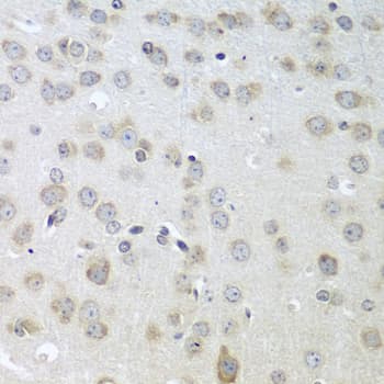PathPlus™ Polyclonal Rabbit anti-Human ACHE / Acetylcholinesterase Antibody (IHC, WB)