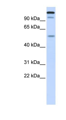NIRF / UHRF2 Antibody (aa540-589)