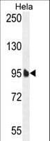 EFTUD1 Antibody (aa1062-1090)