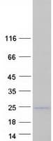 Human SNTN Protein (Recombinant Myc-DDK (Flag))